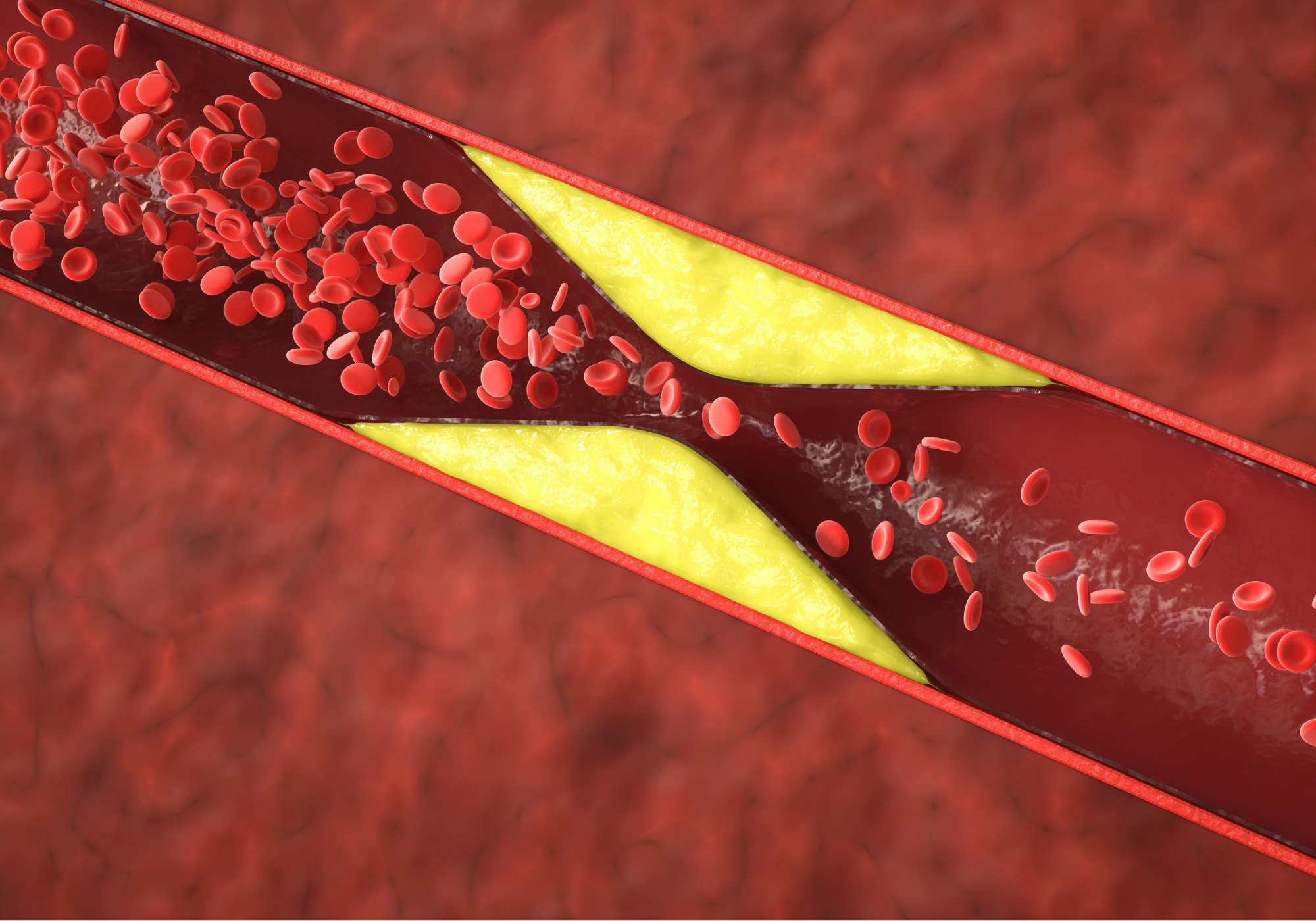 Cholesterol Balans Voedingssupplementen